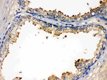 BMPR1B Rabbit Polyclonal Antibody