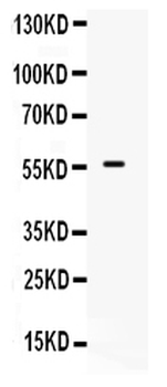 Anti-BMPR1B Antibody