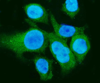 Anti-Carbonic Anhydrase I/CA1 Antibody