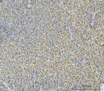Anti-Carbonic Anhydrase I/CA1 Antibody