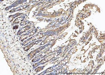 Anti-Carbonic Anhydrase I/CA1 Antibody
