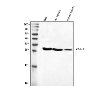 Anti-Carbonic Anhydrase I/CA1 Antibody