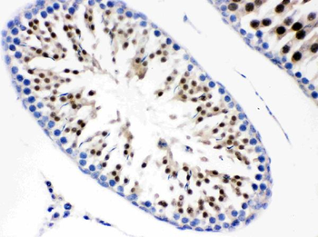 Anti-Cdc6 Antibody