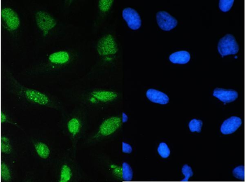 Anti-CDK1 Antibody