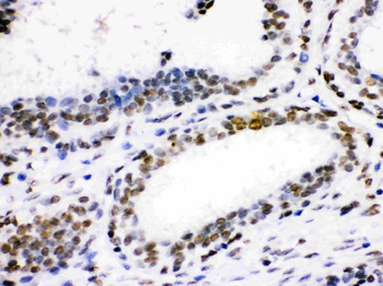 Anti-CDK1 Antibody