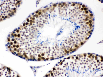 Anti-CDK1 Antibody
