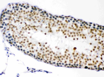 Anti-CDK1 Antibody