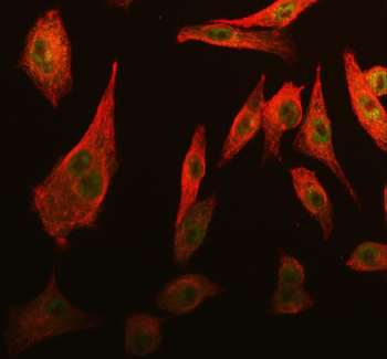 Cdk2 Rabbit Polyclonal Antibody
