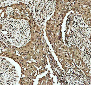 Cdk2 Rabbit Polyclonal Antibody