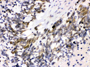 Anti-Cdk4 Antibody