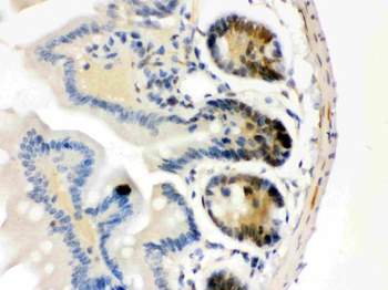 Anti-Cdk4 Antibody