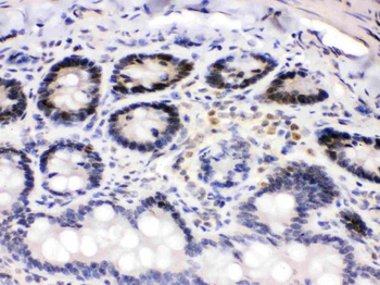 Anti-Cdk4 Antibody