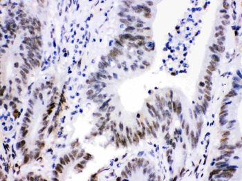 Cdk9 Rabbit Polyclonal Antibody