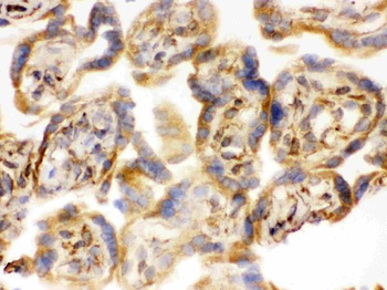 Anti-COMT Antibody