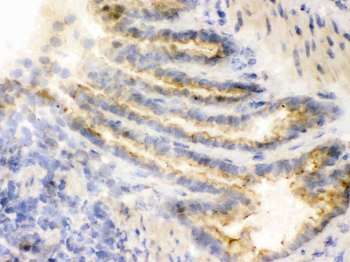 Anti-COMT Antibody