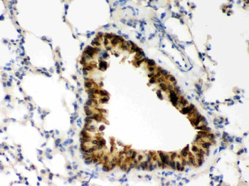 Anti-COMT Antibody