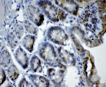Cryptochrome I/CRY1 Antibody