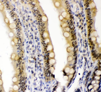 Anti-Cryptochrome I/CRY1 Antibody