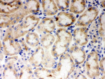 Anti-Cytochrome P450 1A1/CYP1A1 Antibody