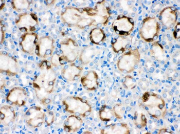 Anti-Cytochrome P450 1A1/CYP1A1 Antibody