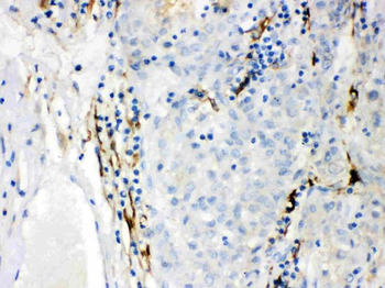 Anti-CYP1B1 Antibody