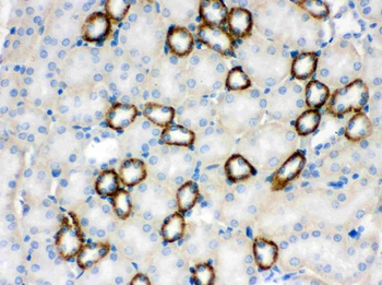 Anti-CYP1B1 Antibody