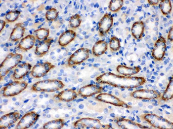 Anti-CYP1B1 Antibody