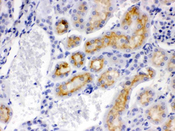 Anti-CYP24A1 Antibody