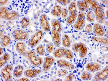 Anti-CYP24A1 Antibody