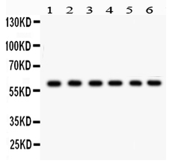 Anti-CYP24A1 Antibody