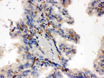 CYP27B1 Antibody