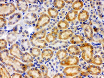 Anti-CYP27B1 Antibody