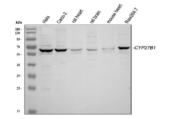 Anti-CYP27B1 Antibody