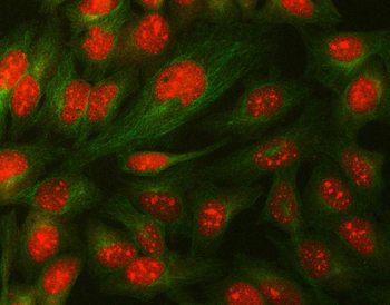 Anti-Daxx Antibody