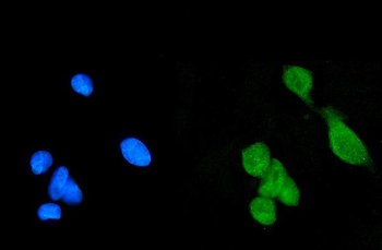 Anti-Daxx Antibody