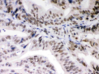 Anti-Daxx Antibody
