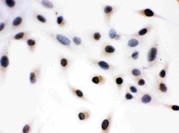 Anti-Daxx Antibody