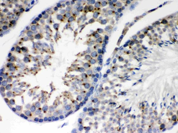 Anti-EBAG9 Antibody