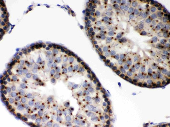 Anti-EBAG9 Antibody