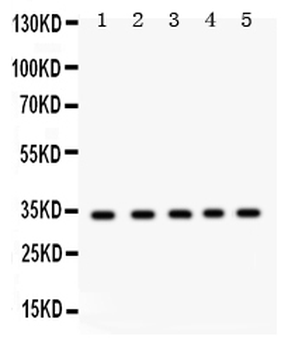 Anti-EBAG9 Antibody