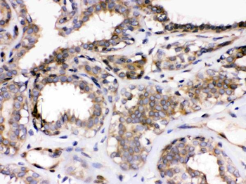 Parvin alpha/PARVA Antibody