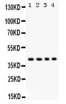 Anti-Parvin alpha/PARVA Antibody