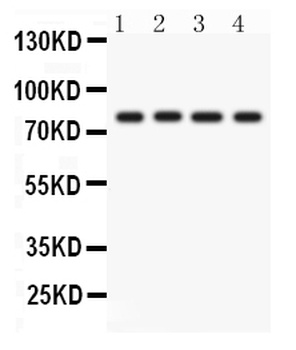 PKC eta/PRKCH Antibody