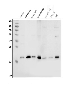 Stathmin 1/STMN1 Antibody