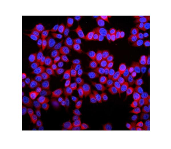 Anti-Stathmin 1/STMN1 Antibody