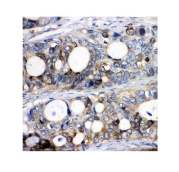 Anti-Stathmin 1/STMN1 Antibody
