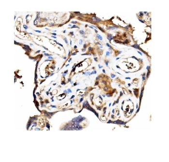 Anti-Stathmin 1/STMN1 Antibody