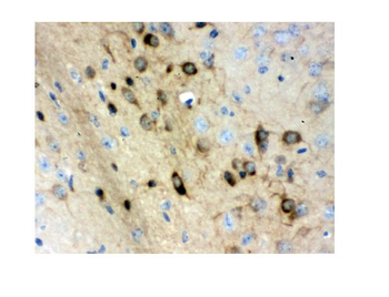 Anti-Stathmin 1/STMN1 Antibody