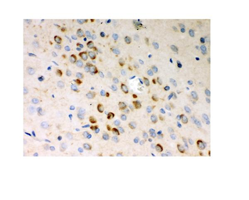 Anti-Stathmin 1/STMN1 Antibody