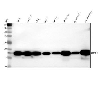 Anti-Stathmin 1/STMN1 Antibody